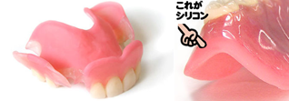 針金のない入れ歯・義歯