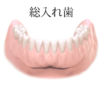 総入れ歯