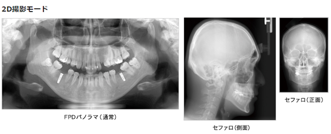 アーム型X線CT診断装置　AUGE SOLIO
