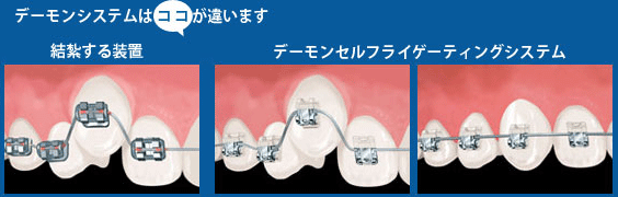 デーモンシステム