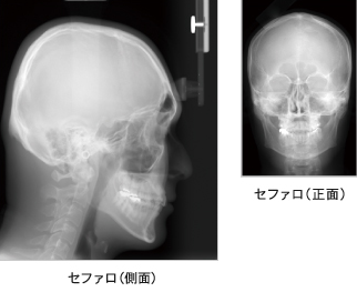 セファロ付きCT診断装置　AUGE SOLIO