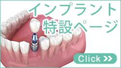 板橋区 インプラント